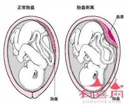 上海助孕费用高吗，上海第三代试管婴儿费用是多少？